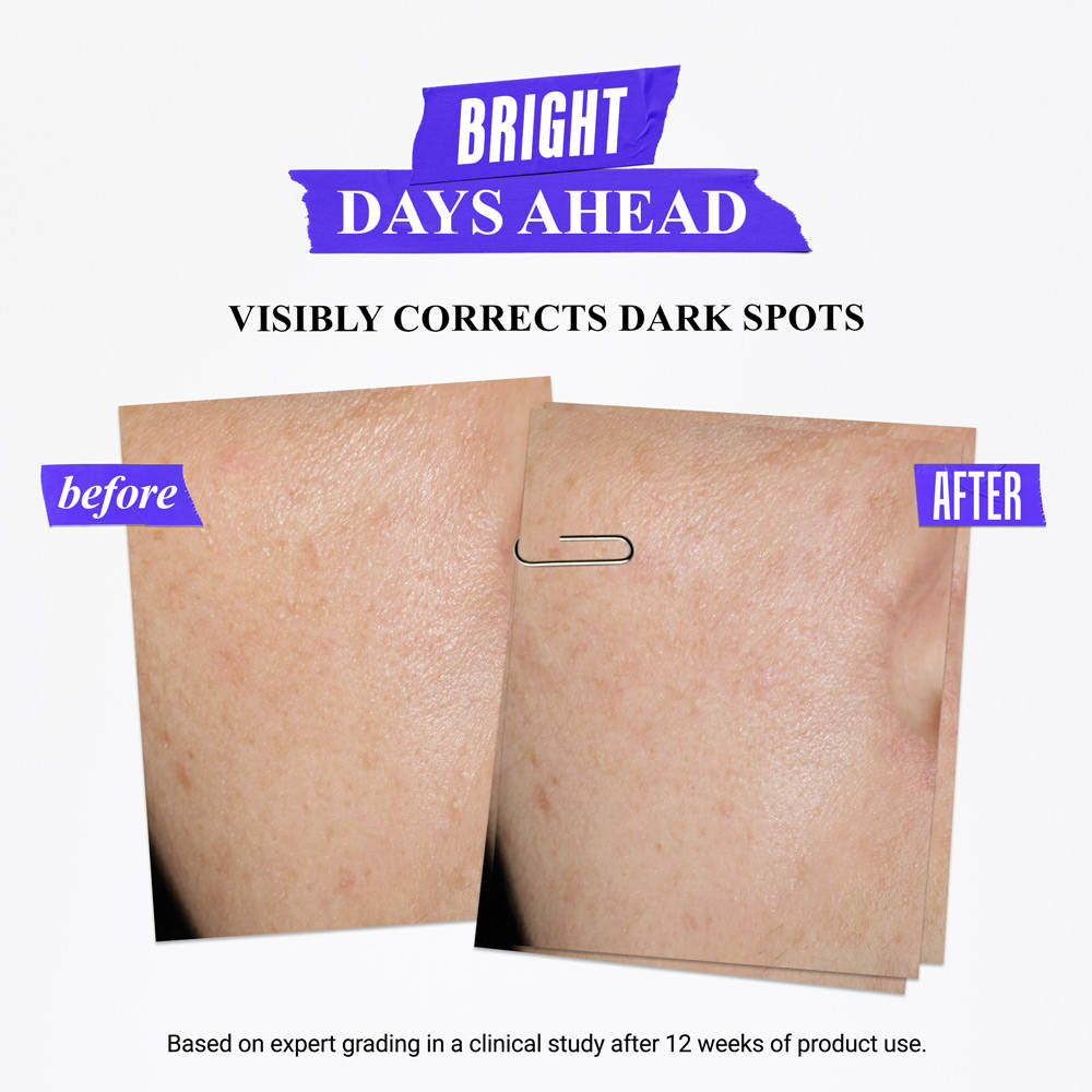 Kiehl's Clearly Corrective Dark Spot Solution With Activated C & Buffered Salicylic Acid (30ml)