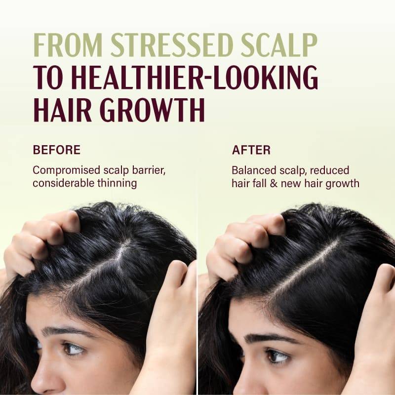 &Done Anti-Hairfall Balancing Shampoo & Restoring Conditioner