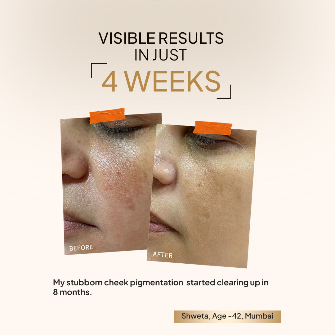 Miduty EpiLight Night Serum