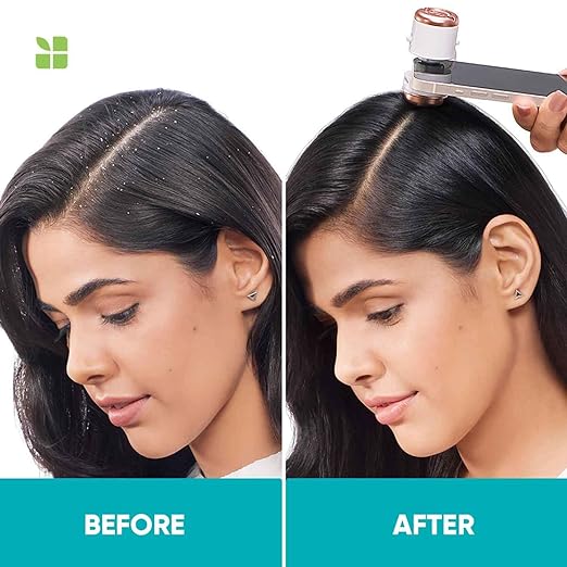 MATRIX BIOLAGE Biolage Scalppure PROFESSIONAL Anti-Dandruff Shampoo| Shampoo for Men & Women 400ml