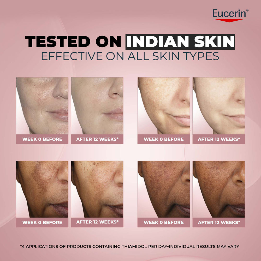 Eucerin Anti-Pigment Dark Circle Eye Corrector Serum With Thiamidol & Hyaluronic Acid For Bright Eye (15ml)