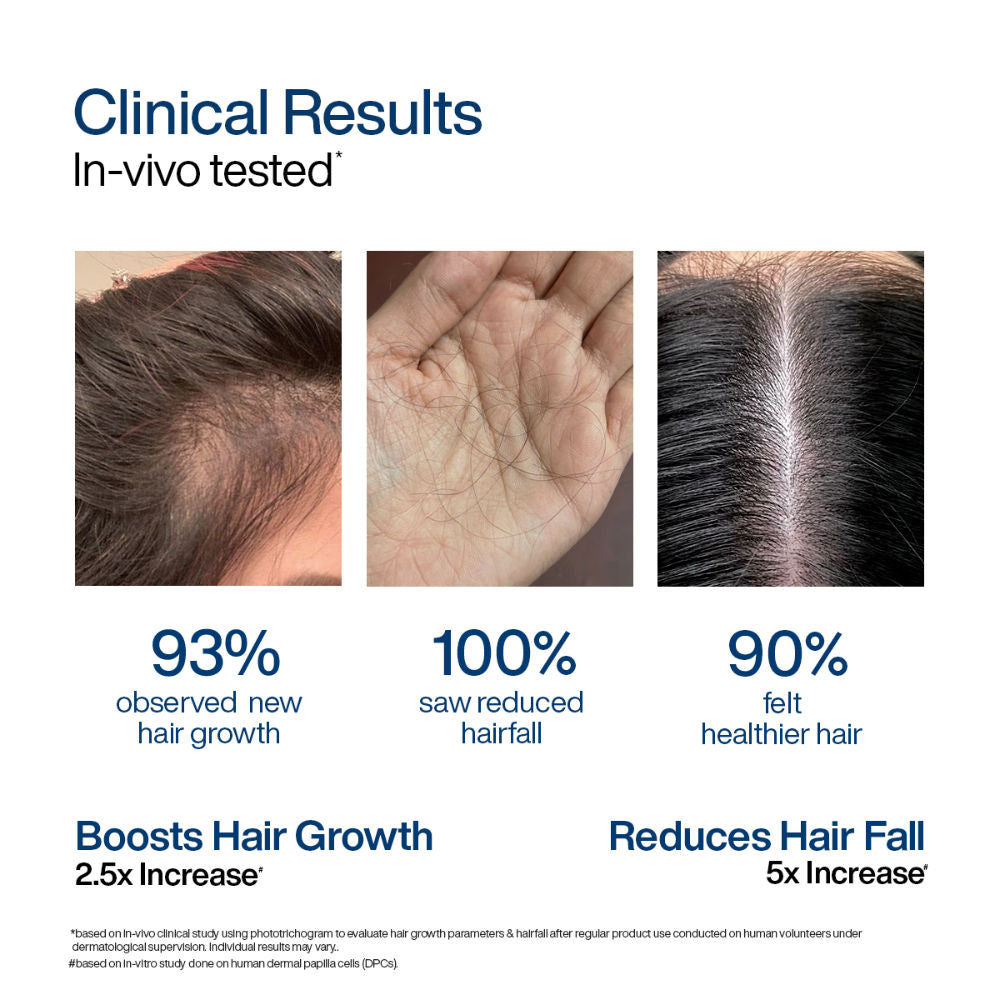 Wishcare Hair Growth Serum Concentrate with Redensyl & Rosemary - In-Vivo Tested - Controls Hairfall (30ml)