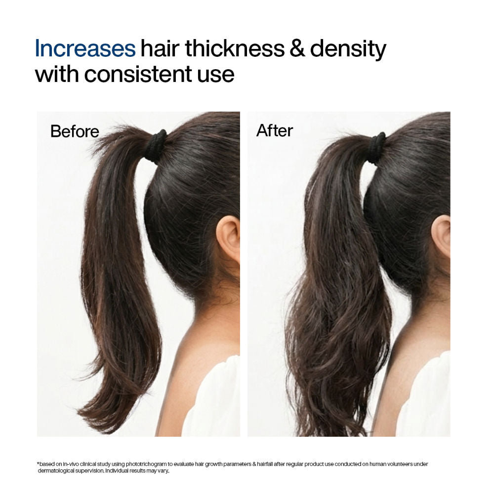 Wishcare Hair Growth Serum Concentrate with Redensyl & Rosemary - In-Vivo Tested - Controls Hairfall (30ml)