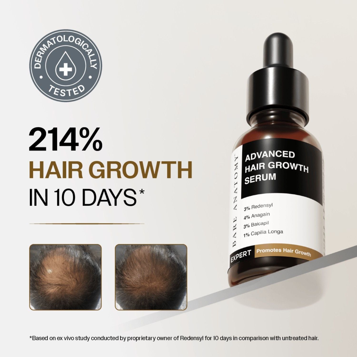 Bare Anatomy Advanced Hair Growth Serum - 3% Redensyl + 4% Anagain + Rosemary + Rice Water (30ml)