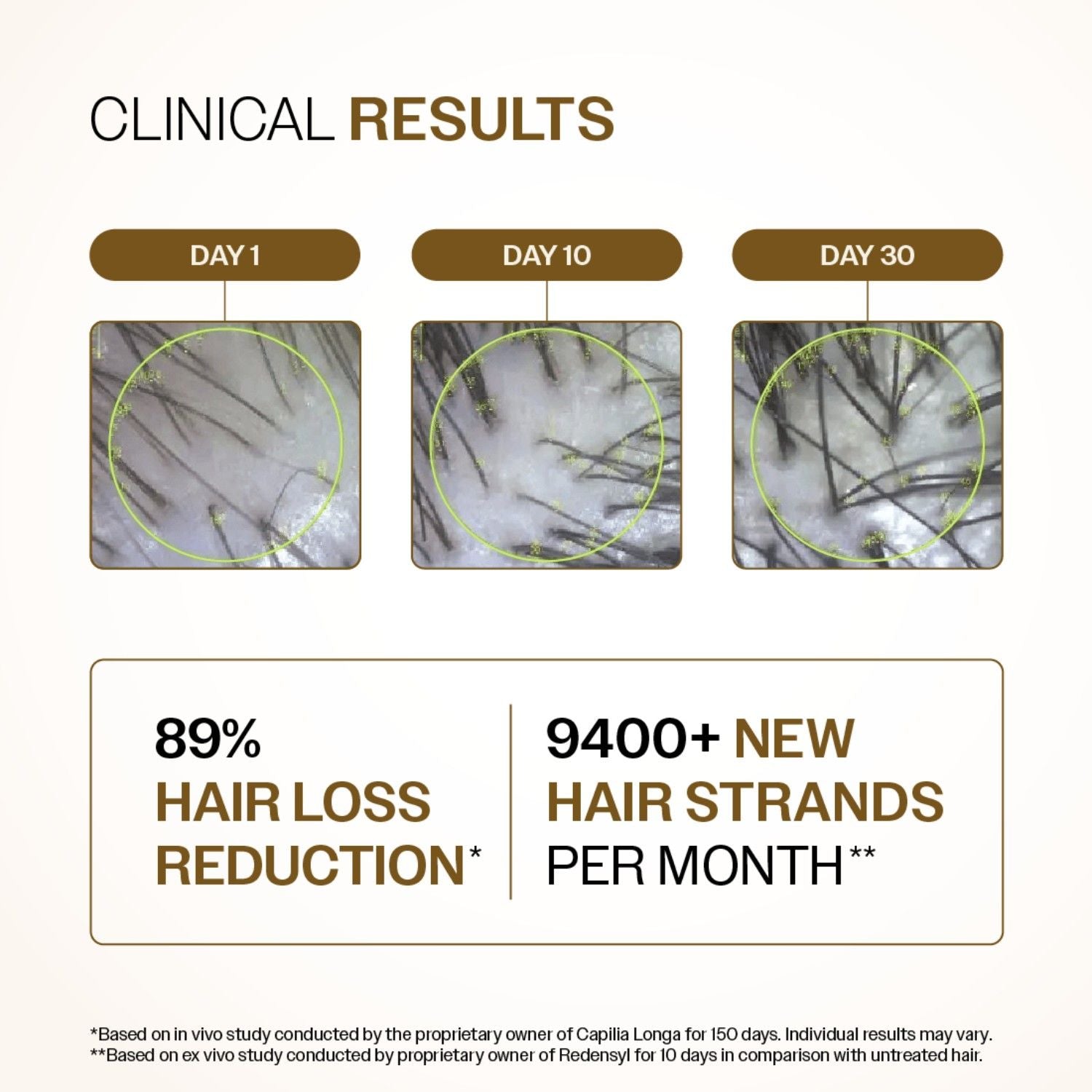 Bare Anatomy Advanced Hair Growth Serum - 3% Redensyl + 4% Anagain + Rosemary + Rice Water (30ml)