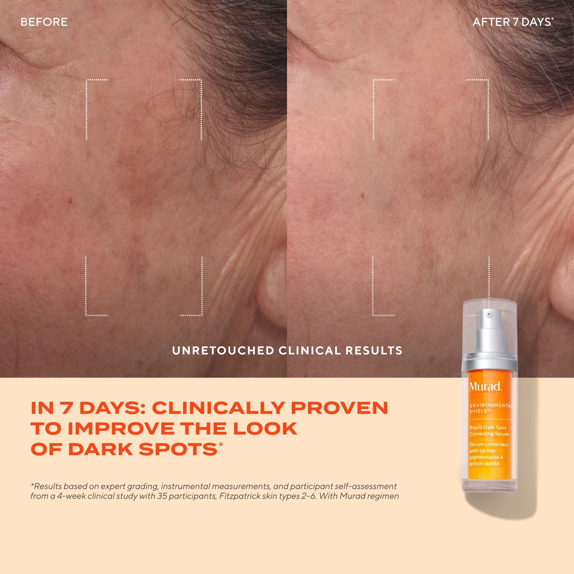 Murad Rapid Dark Spot Correcting Serum (30ml)