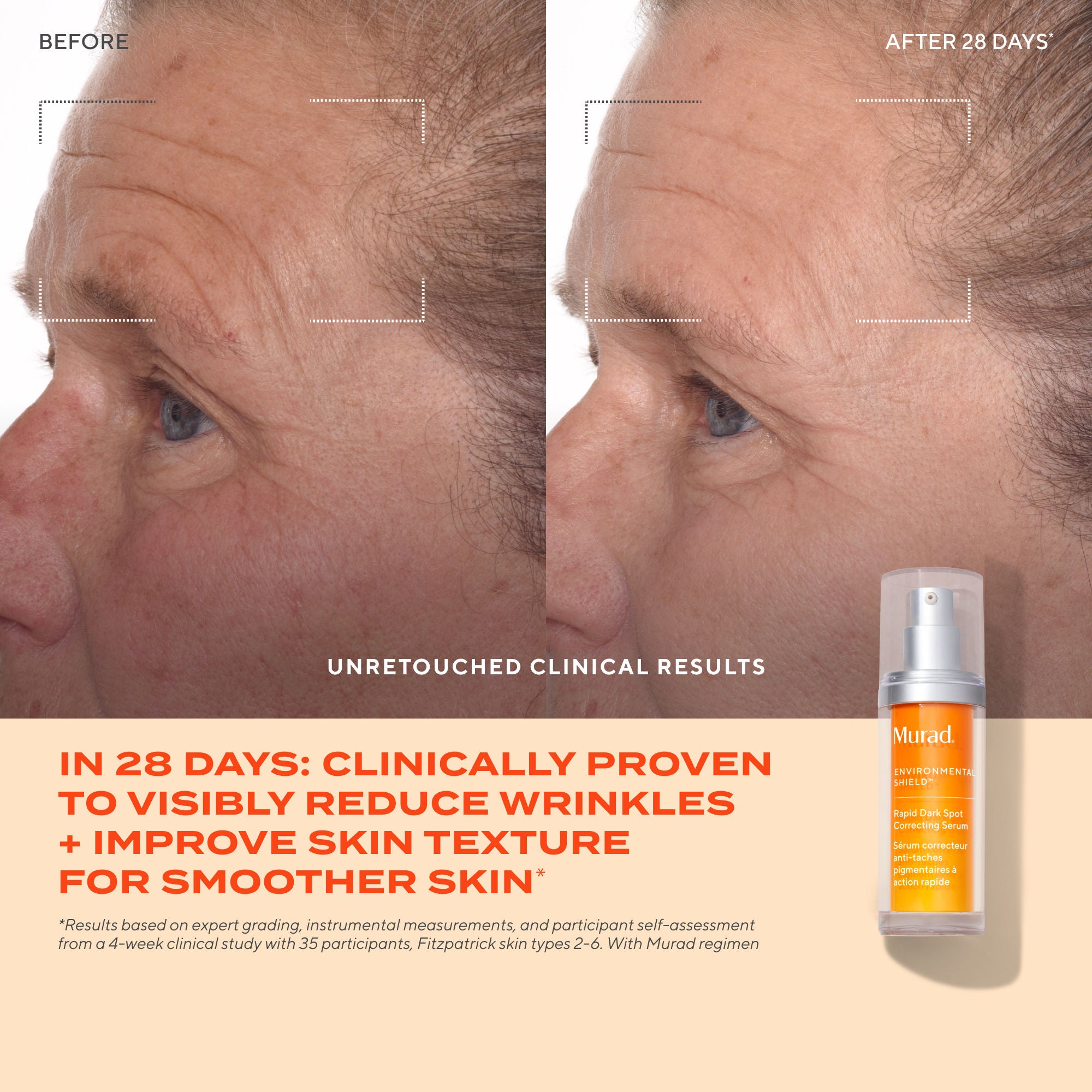 Murad Rapid Dark Spot Correcting Serum (30ml)