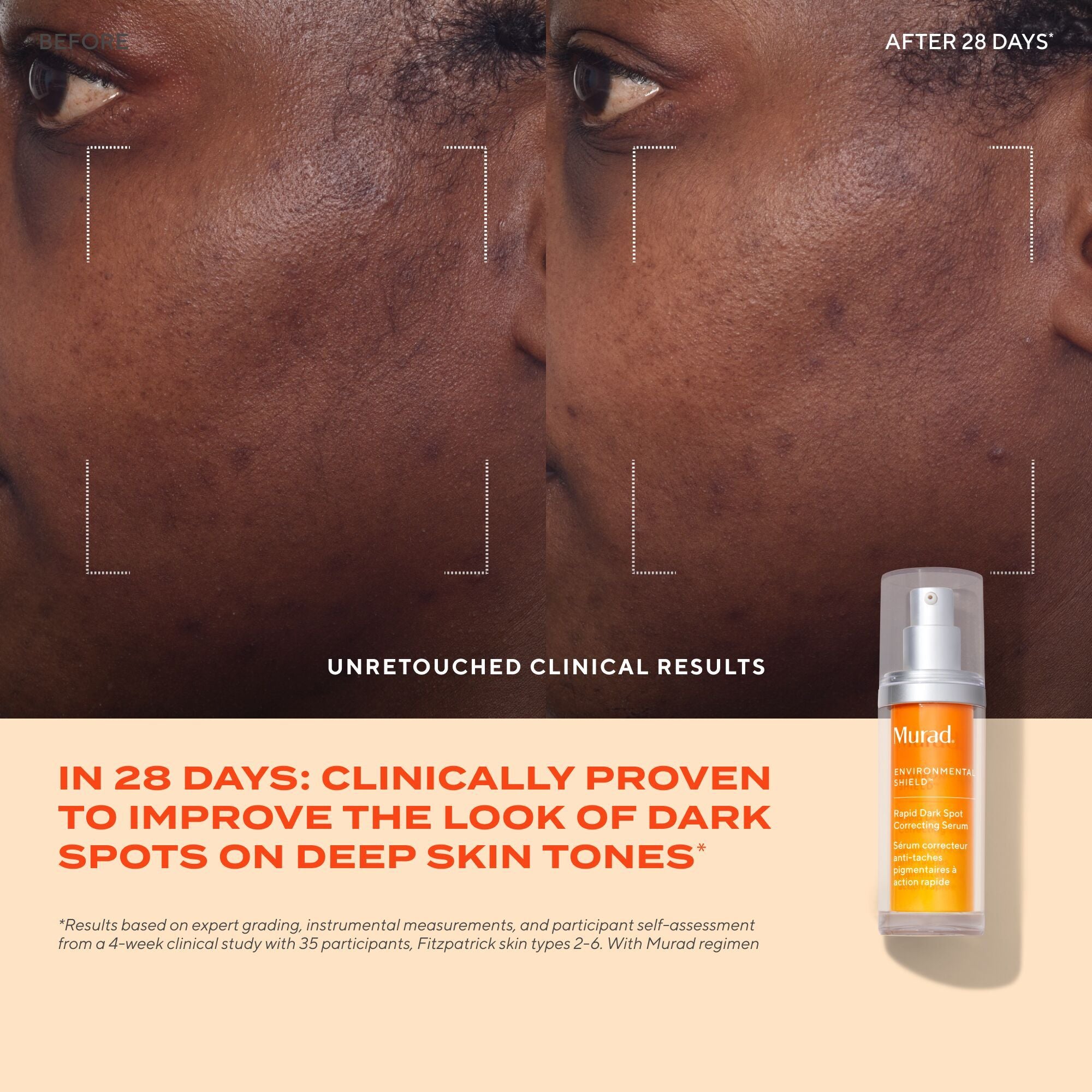 Murad Rapid Dark Spot Correcting Serum (30ml)