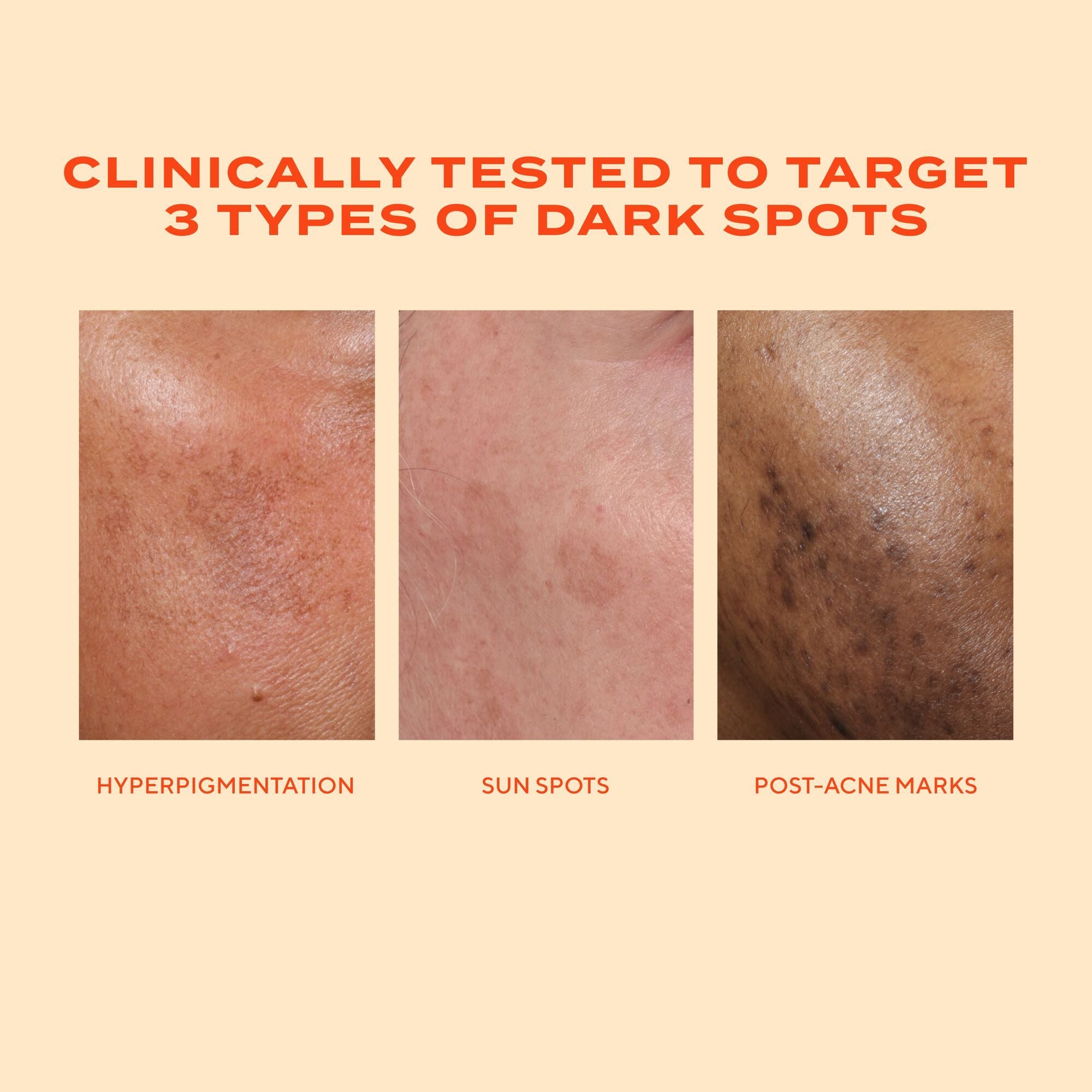 Murad Rapid Dark Spot Correcting Serum (30ml)