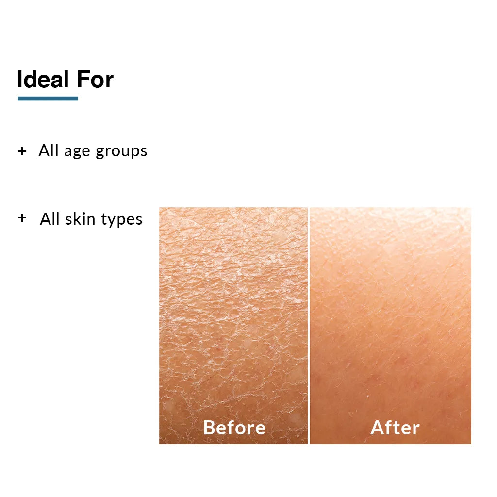Fix Derma - 1% Sodium PCA, 2% Shea Butter, 0.5% Vitamin E - Moisturizing Lotion (150mL)