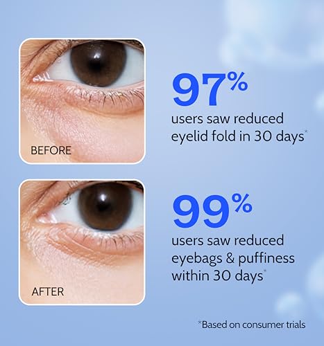 Chemist at Play 30x Vitamin C Face Wash, 10% Vitamin C Face Serum & Under Eye Cream Combo | Fades Dark Spots, Brightens & Reduces Dark Circles & Puffiness | 100