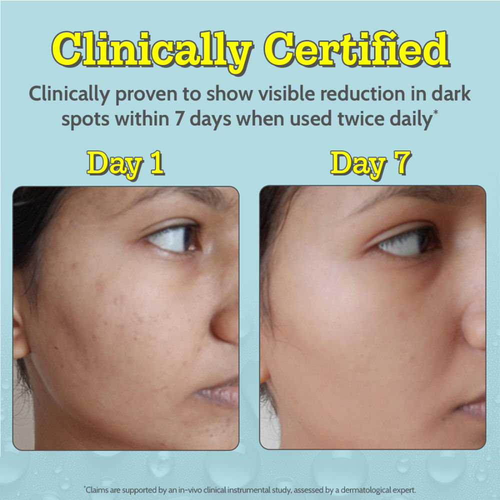 Chemist At Play 10% Vitamin C Face Serum |Brightens Skin |Treats Dark Spots & Hyperpigmentation (30ml)