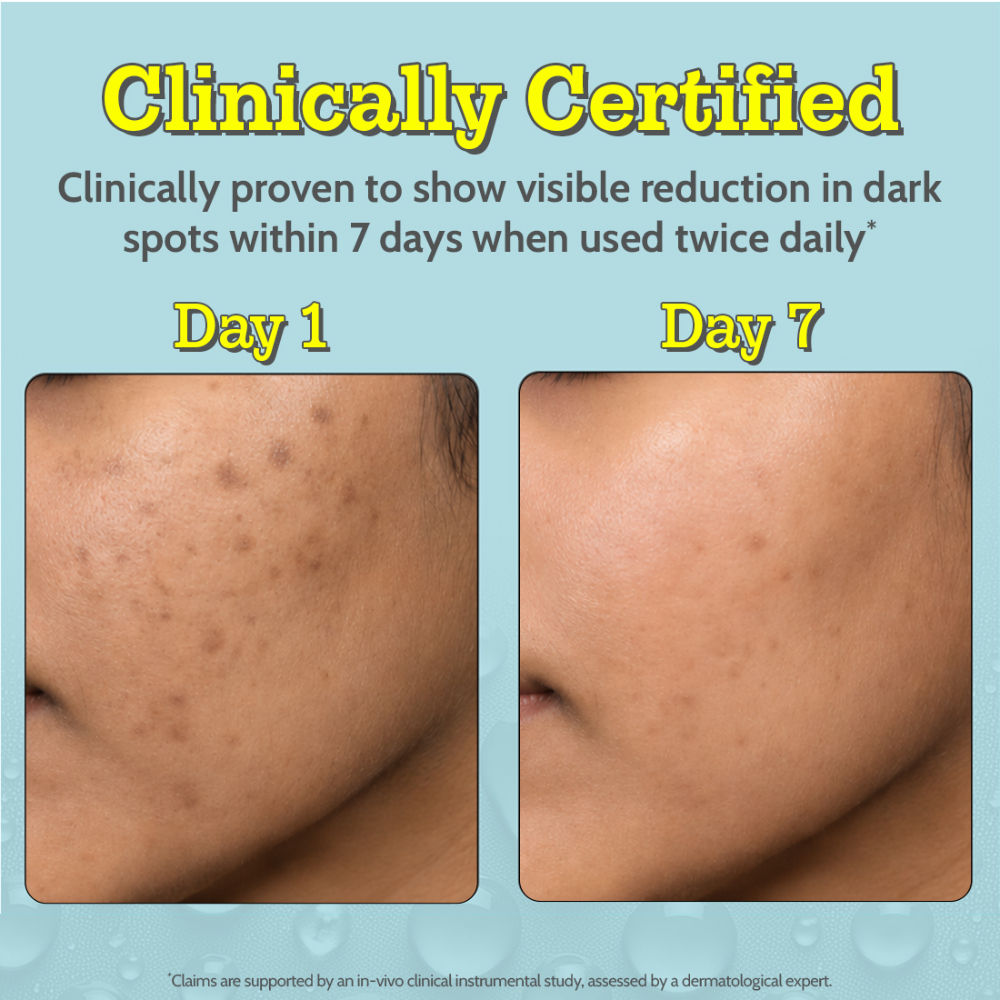 Chemist At Play 10% Vitamin C Face Serum |Brightens Skin |Treats Dark Spots & Hyperpigmentation (30ml)