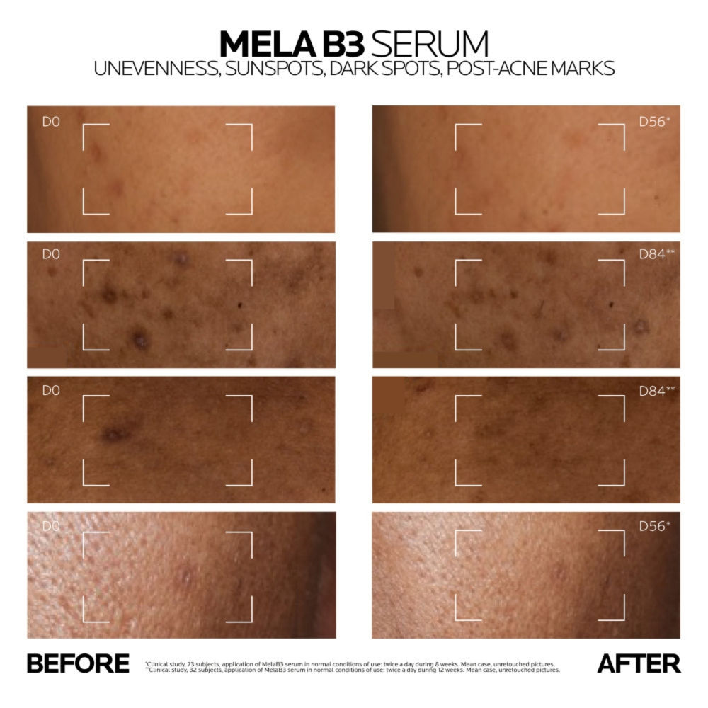 La Roche-Posay Mela B3 Serum (10ml)
