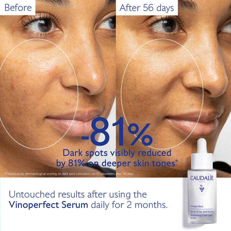 Caudalie Vinoperfect Brightening Dark Spot Serum (30ml)