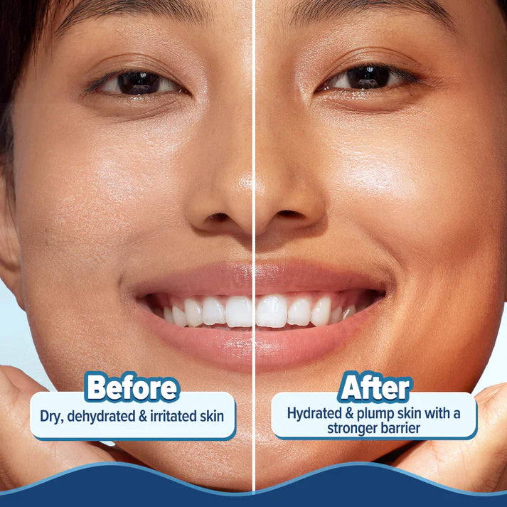Aqualogica – 5 Barrier+ Hydra Gel Moisturizer with Avocado & 5 Essential Ceramides -(200 g)