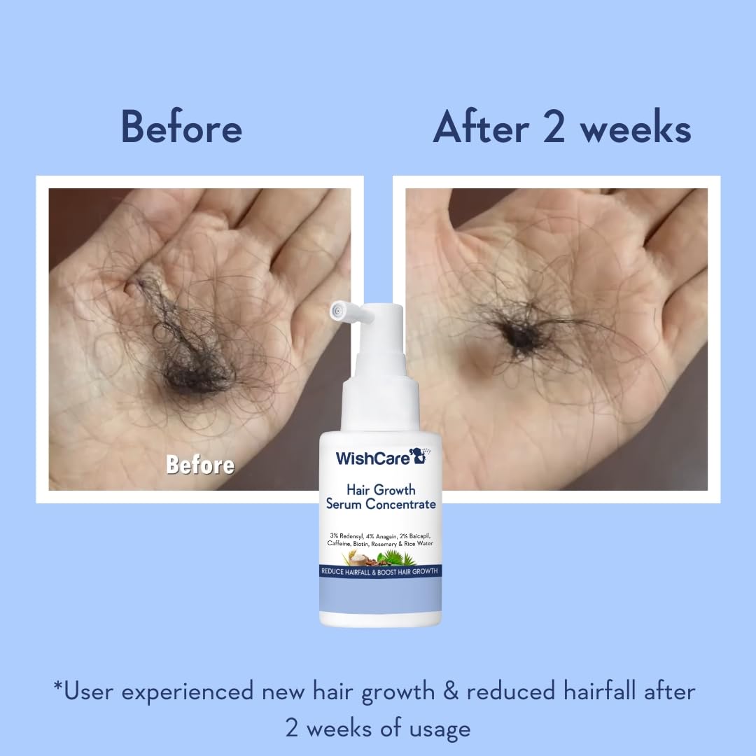 WishCare Hair Growth Serum For Scalp | 94% Saw New Hair Growth | Redensyl & Rosemary Oil | 100% Saw Hairfall Reduction | In-Vivo Tested | For Men & Women | 30ml