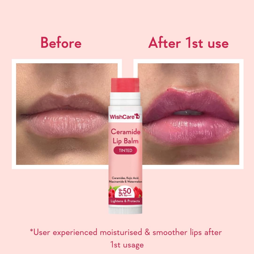 WishCare Tinted Lip Balm SPF 50 PA+++ | Brightening Lip Balm for Dark Lips | In-Vivo Tested | Kojic Acid & Niacinamide | For Women | 5g