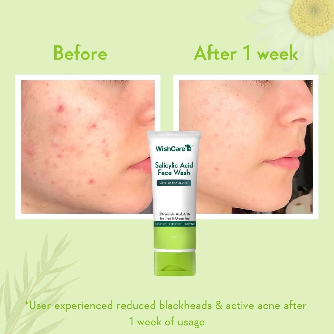 WishCare Salicylic Face Wash with AHA, Green Tea, Chamomile & Tea Tree – Gentle Cleanser for Oily Skin, 100ml