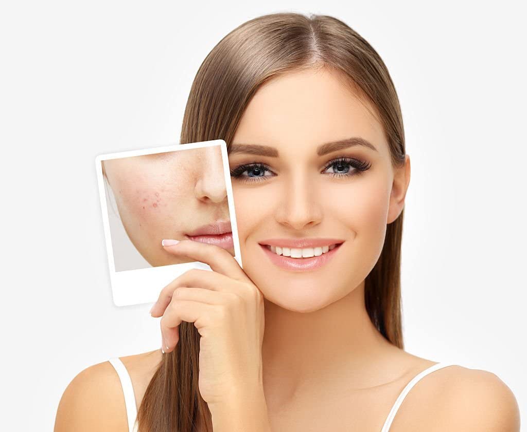 Multani Mitti Powder, Bentonite Clay, Fuller's Earth Clay, Face Pack, Glowing skin, Oil Control, Fades Acne Scars & Ageing Marks, Natural Hair & Skin, Skin Whit