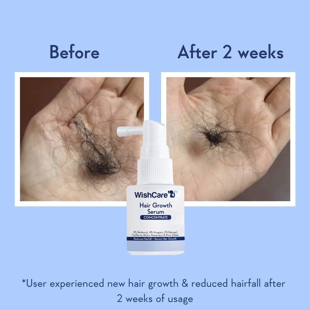 WishCare Hair Growth Serum Concentrate - Resdensyl, Anagain, Caffeine, Biotin, Keratin & Rice Water 20ml