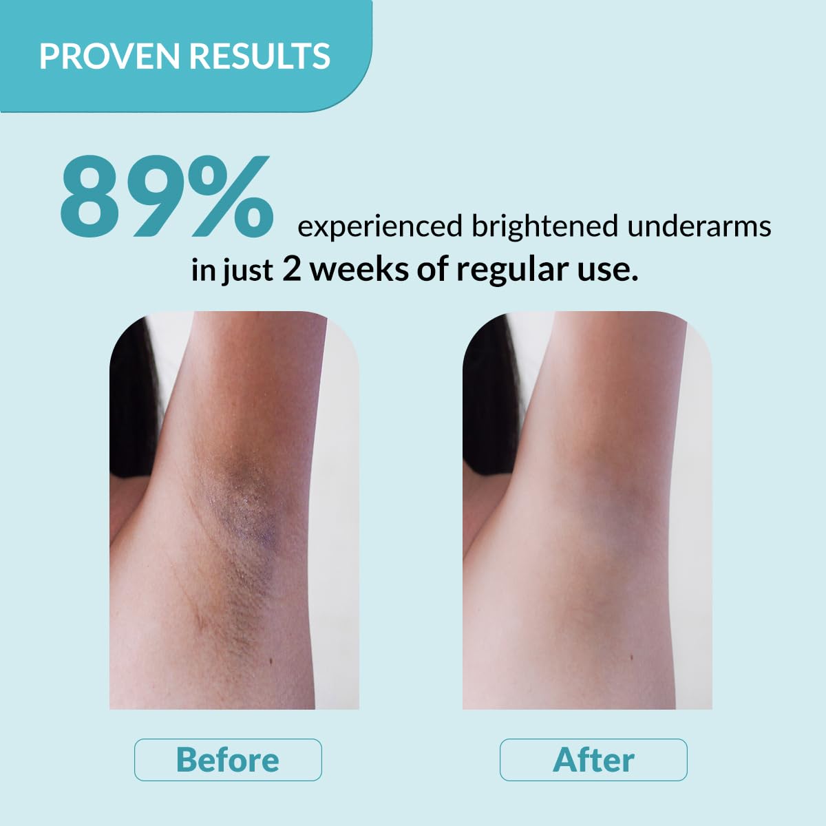 Fixderma Nigrifix Underarm Roll on with 6% AHA, Lactic Acid & 1% Mandelic Acid & Kojic Acid | Brightens Skin & Exfoliates Underarm | For All Skin Type, Men & Wo