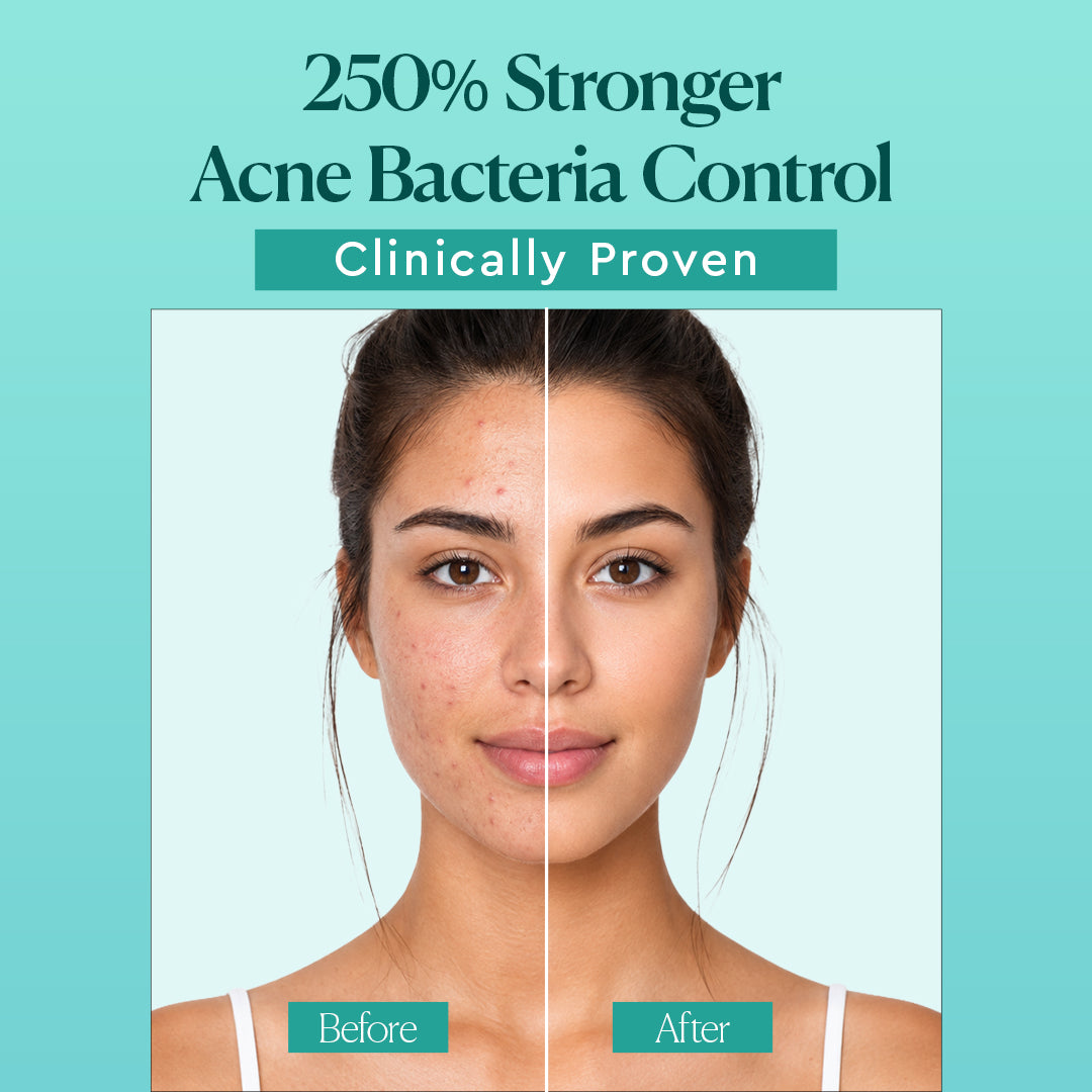 The Face Shop Dr Belmeur AHA BHA Sebum Control Gel Cleanser For Acne Prone Skin With Salicylic Acid