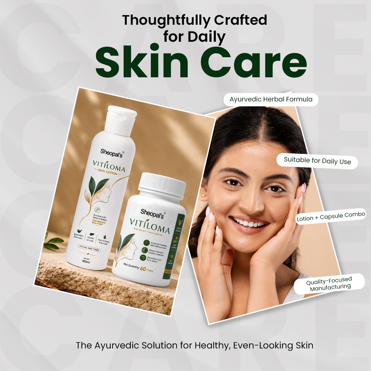 Sheopal's Vitiloma Combo | Skin Lotion & Capsules for Healthy-Looking Skin Tone | White Patches, Discoloration of Scar Removal, Piebald, for men and women ((Com