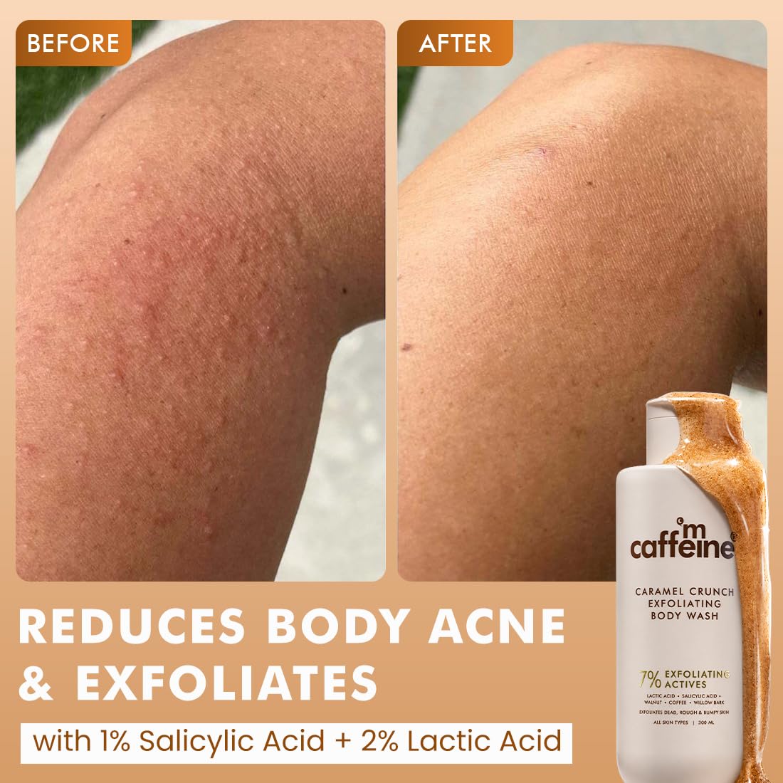 mCaffeine Smooth Skin & Floral Bliss Duo | 7% Exfoliating Body Wash | 1% Salicylic & 2% Lactic Acid | Reduces Body Acne & Ingrown Hair | Sweet Escape Perfume Bo