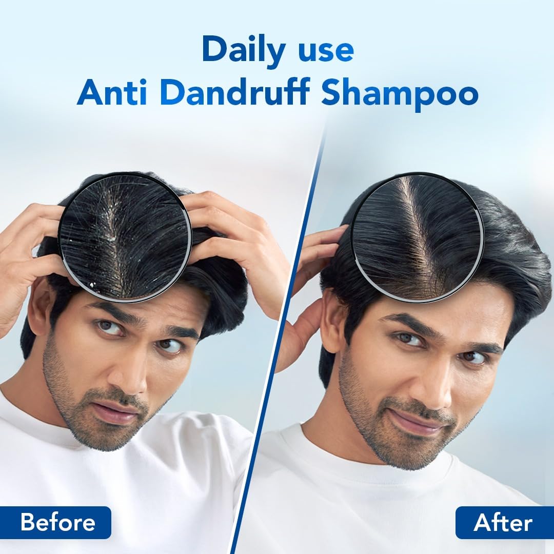 Scalpe Pro Anti Dandruff Shampoo (200ml) and Daily Anti-Dandruff Shampoo (100ml) with Climbazole & ZPTO Formulation