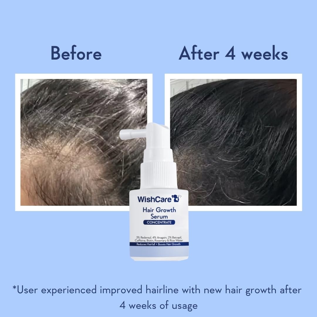 WishCare Hair Growth Serum Concentrate - Resdensyl, Anagain, Caffeine, Biotin, Keratin & Rice Water 20ml