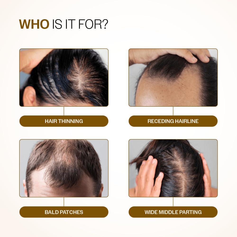 Bare Anatomy Advanced Hair Growth Serum Roll-On | Women & Men | 25ml Hair Growth Serum Roll-On 25 ml (Pack of 1)