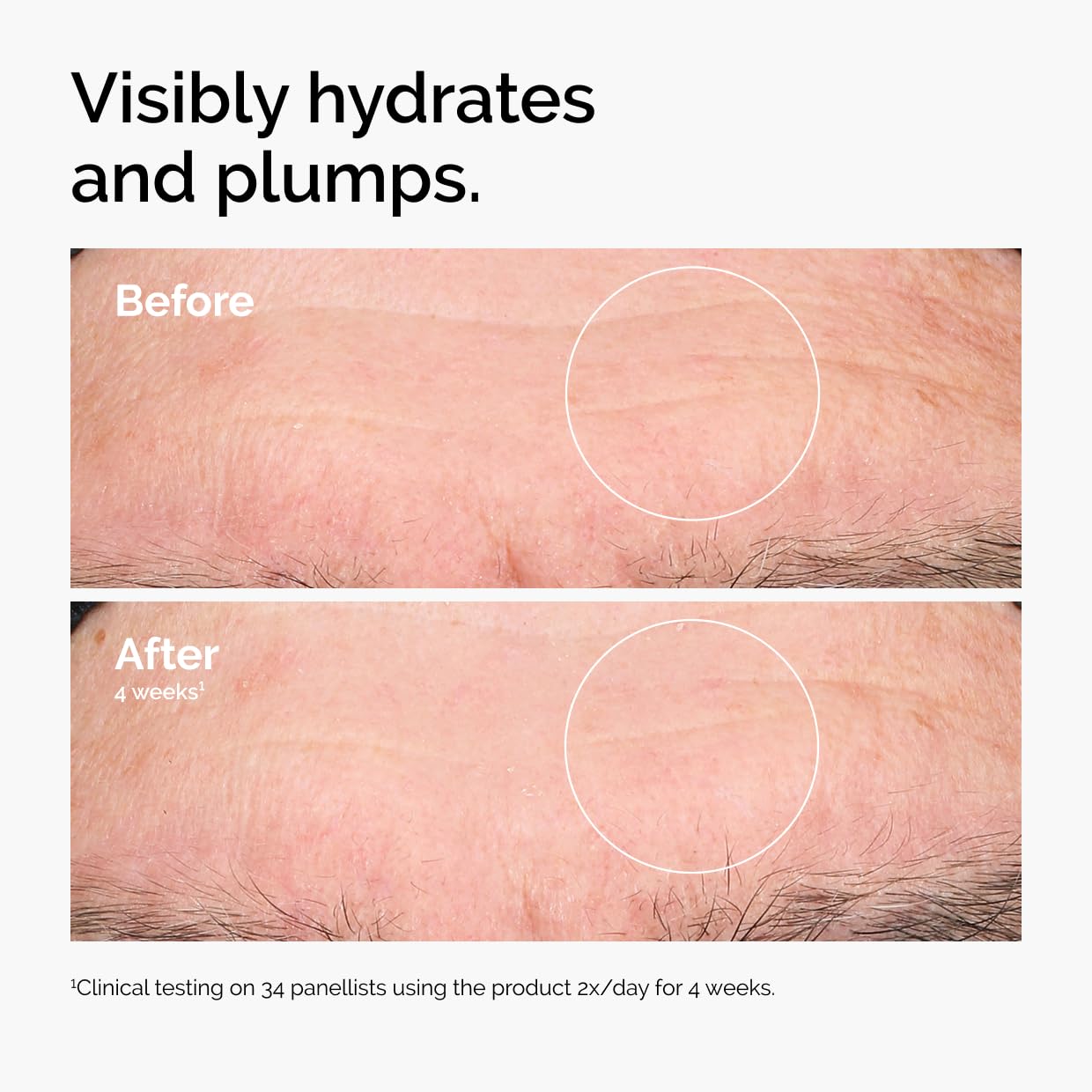The Ordinary Hyaluronic Acid 2% + B5 (with Ceramides), Multi-Depth Hydration Serum for Plumper, Smoother Skin