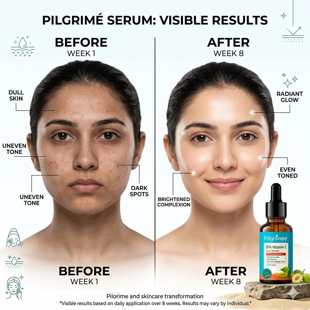 Pilgrimee 15% Vitamin C Face Serum for Glowing Skin