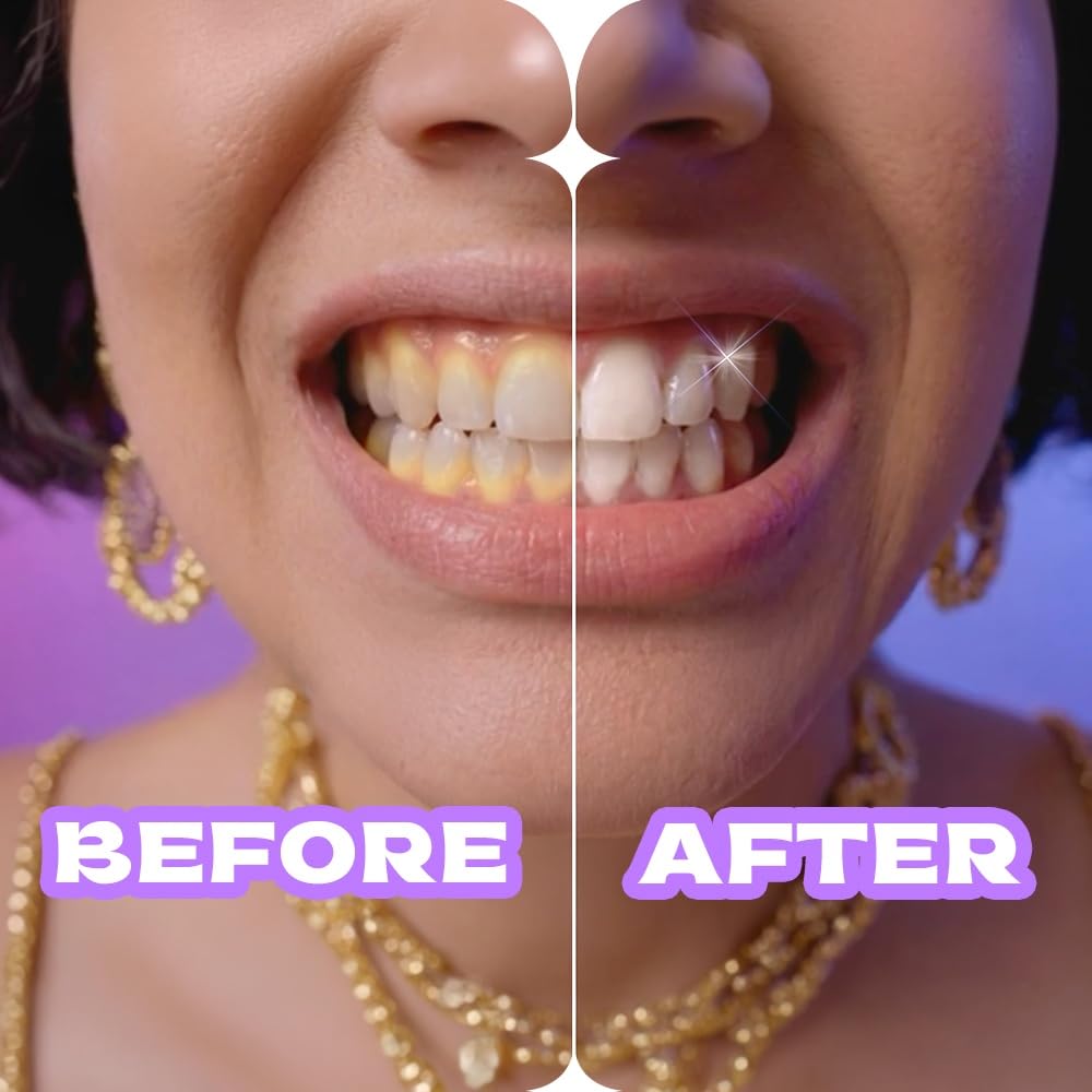 Close Up White Now Stain Eraser toothpaste for Teeth Whitening | Removes 100% surface stains to whiten teeth| Minty Fresh | Enamel safe & for daily use 100g