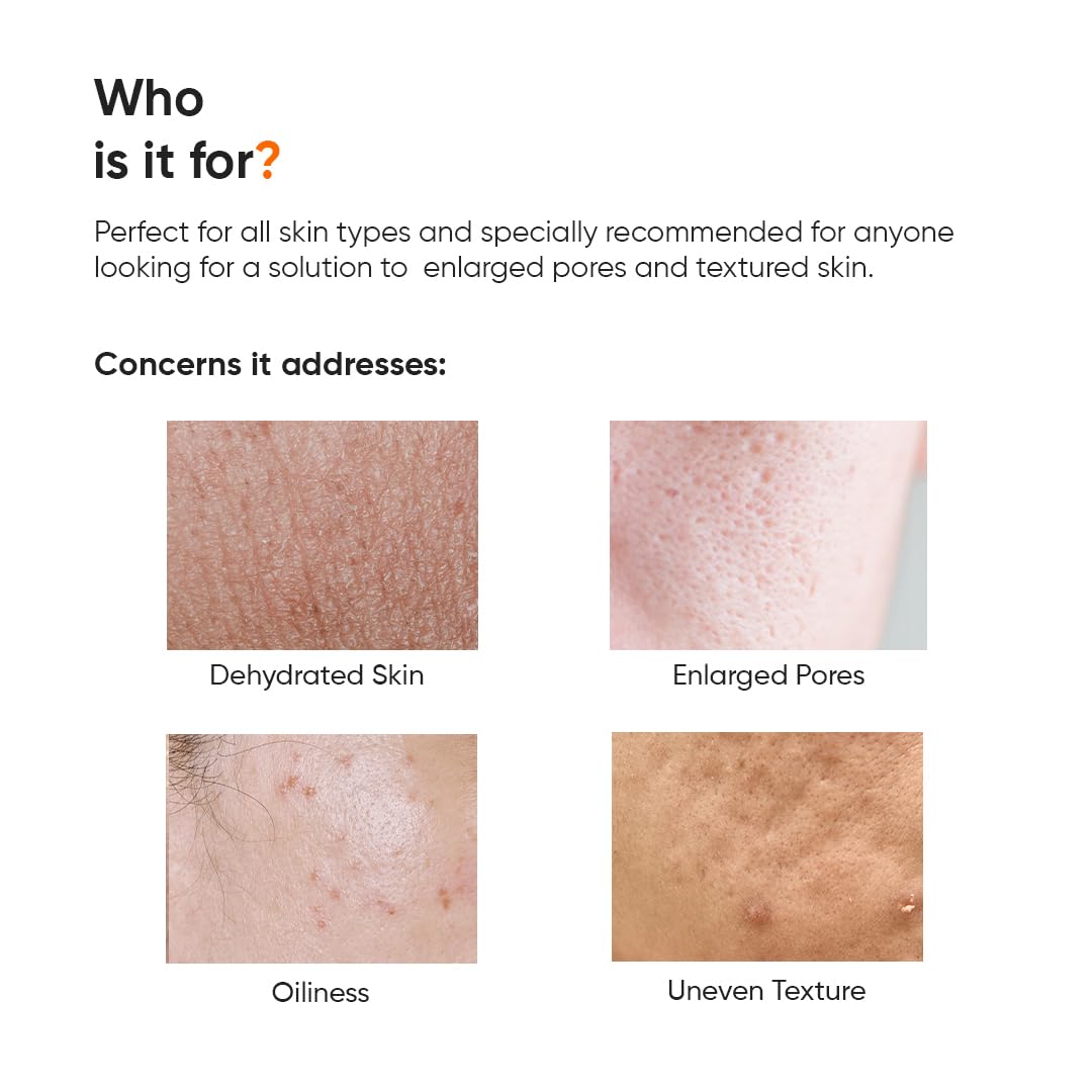 Minimalist Anti Acne PHA 3% Face Toner for Oily Skin | Pore Tightening & Mild Exfoliation For All Skin | Alcohol Free Hydrating Face Toner For Glowing Skin | 150 ml
