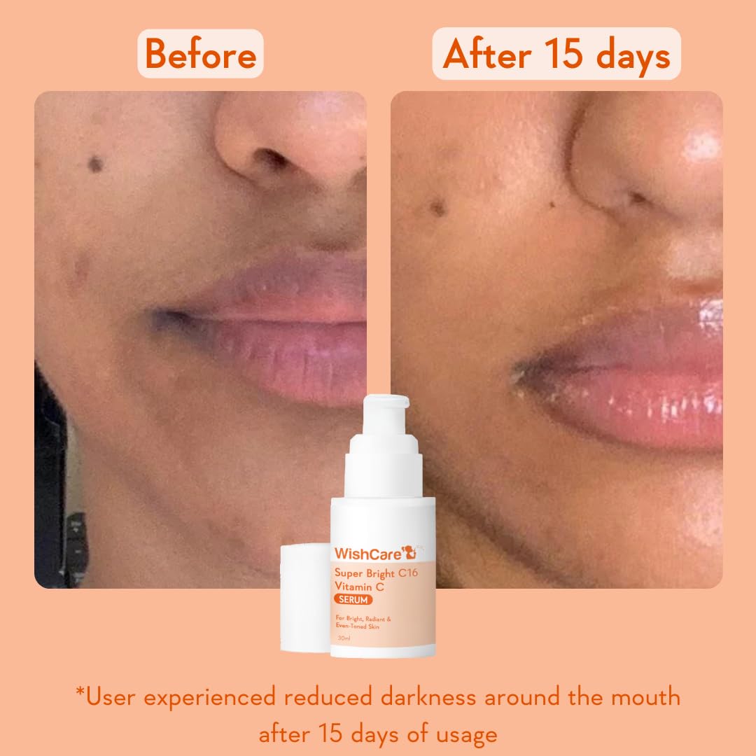 WishCare Vitamin C Face Serum with Niacinamide, Ferulic Acid & Botanical Extracts – Serum for All Skin Types, 30ml