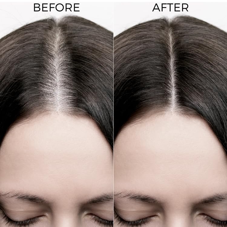 Brillare 20% Rosemary Oil Shots For Rapid Hair Growth | Improves Thickness | Controls Hair Fall & Nourishes Scalp | 100% Natural, Non Greasy Hair Oil Shots For