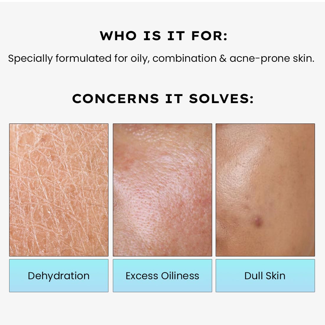 Hyphen 2% Cica Exosomes Oil-Free Moisturizer | 10X Deeper Hydration | Lightweight Water Gel with 5% Niacinamide | Controls Oil, Non-Comedogenic | Acne-Prone, Dr