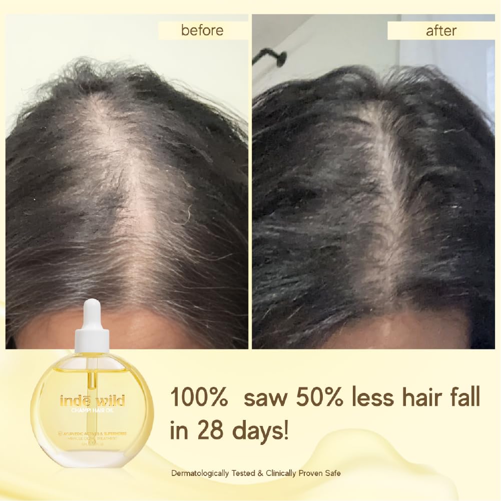 indē wild Champi Hair Oil With Rosemary Oil, Brahmi, Amla, Bhringraj | Ayurvedic, Hair Growth, Controls Dandruff, Hairfall | Soothing Fragrance