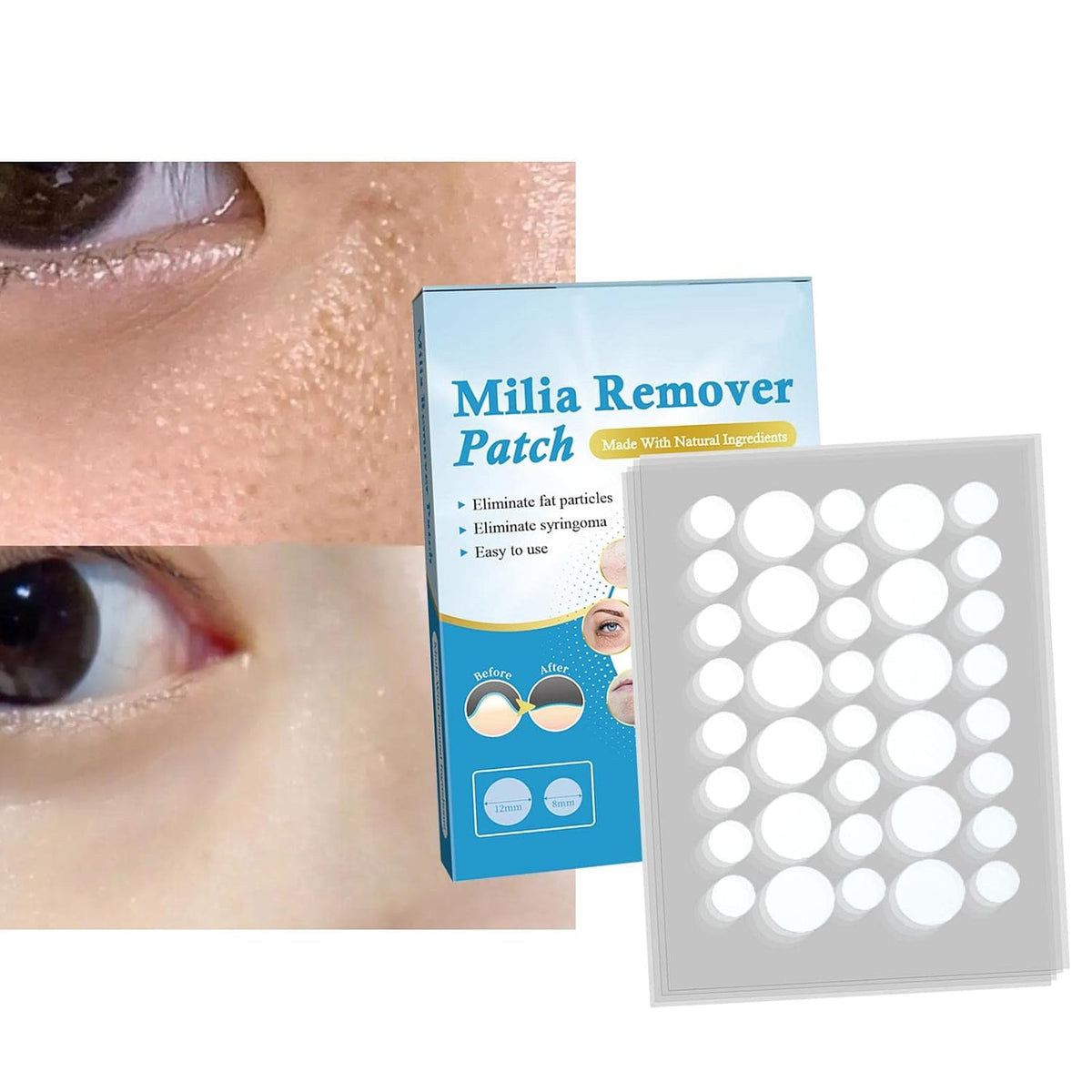 ECOMISTIQ® Pimple Patch Milia Remover Patch Sticker Moisturize Clean | Hydrocolloid Roll Compatible | Acne Spot Corrector Gel Replacement Accessory Kit