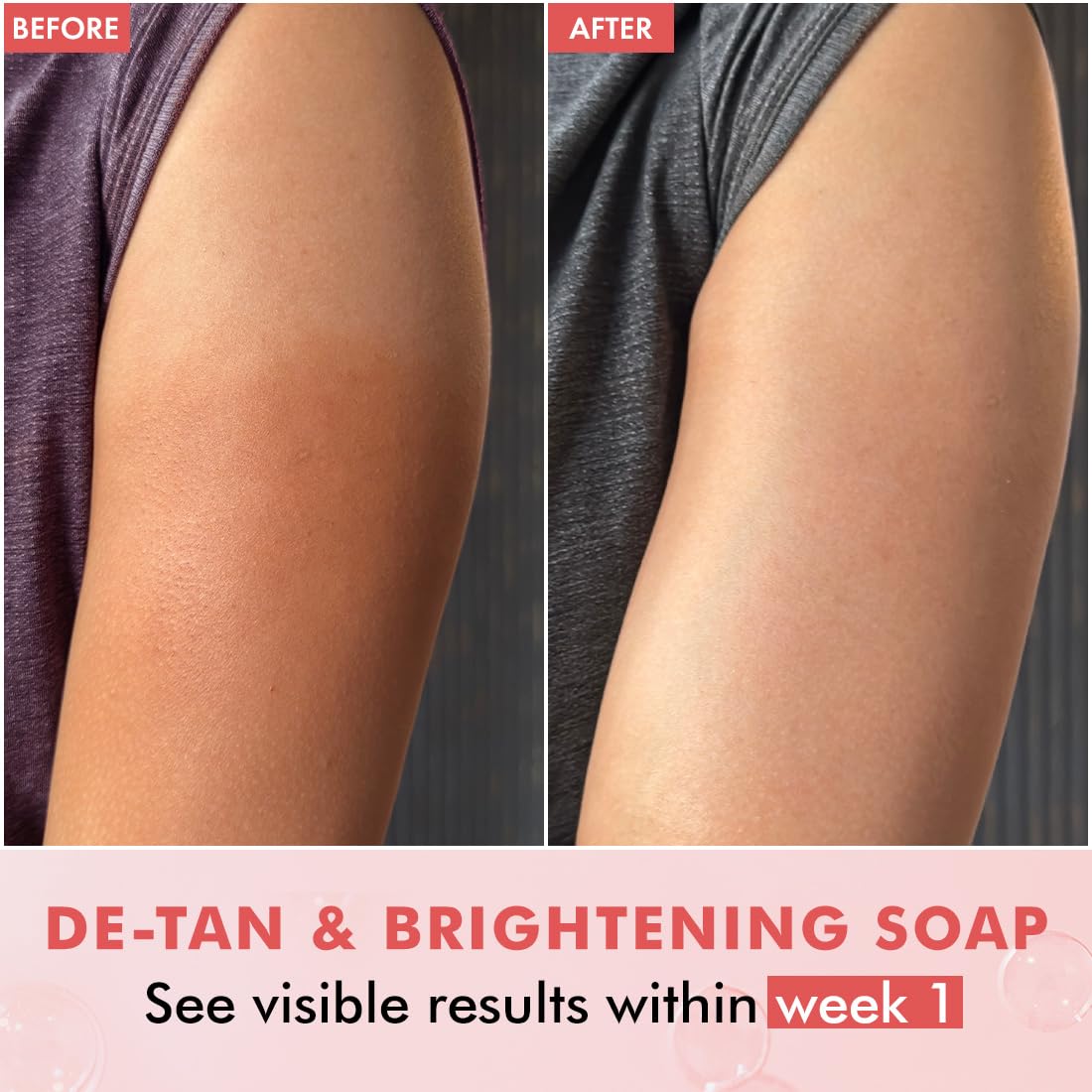mCaffeine Brightening Tan Removal Soap - 1% Kojic Acid & Glutathione -Pack of 3x100g | Niacinamide, Glycolic Acid - Reduce Dark Spots | Tangy Guava Perfumed Bar