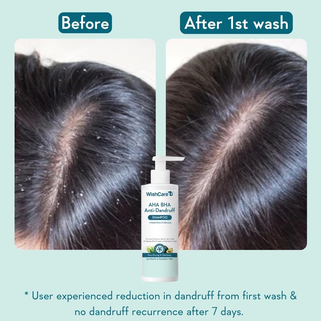 WishCare Hydrating Shampoo | Scalp & Hair Cleansing Formula | Sulfate Free & Paraben Free | For Women & Men | 250 ml