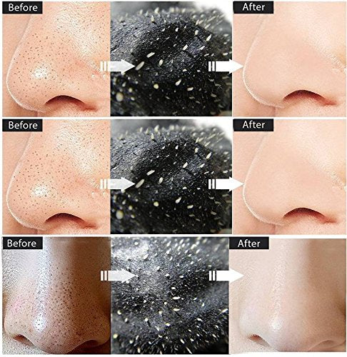 Mond'sub Peel Off Charcoal Mask with Volcanic Soil for removal of Blackheads,Acne Treatment and Oil Control, Black, 200ml (Pack of 2) 100 ml (Pack of 2)