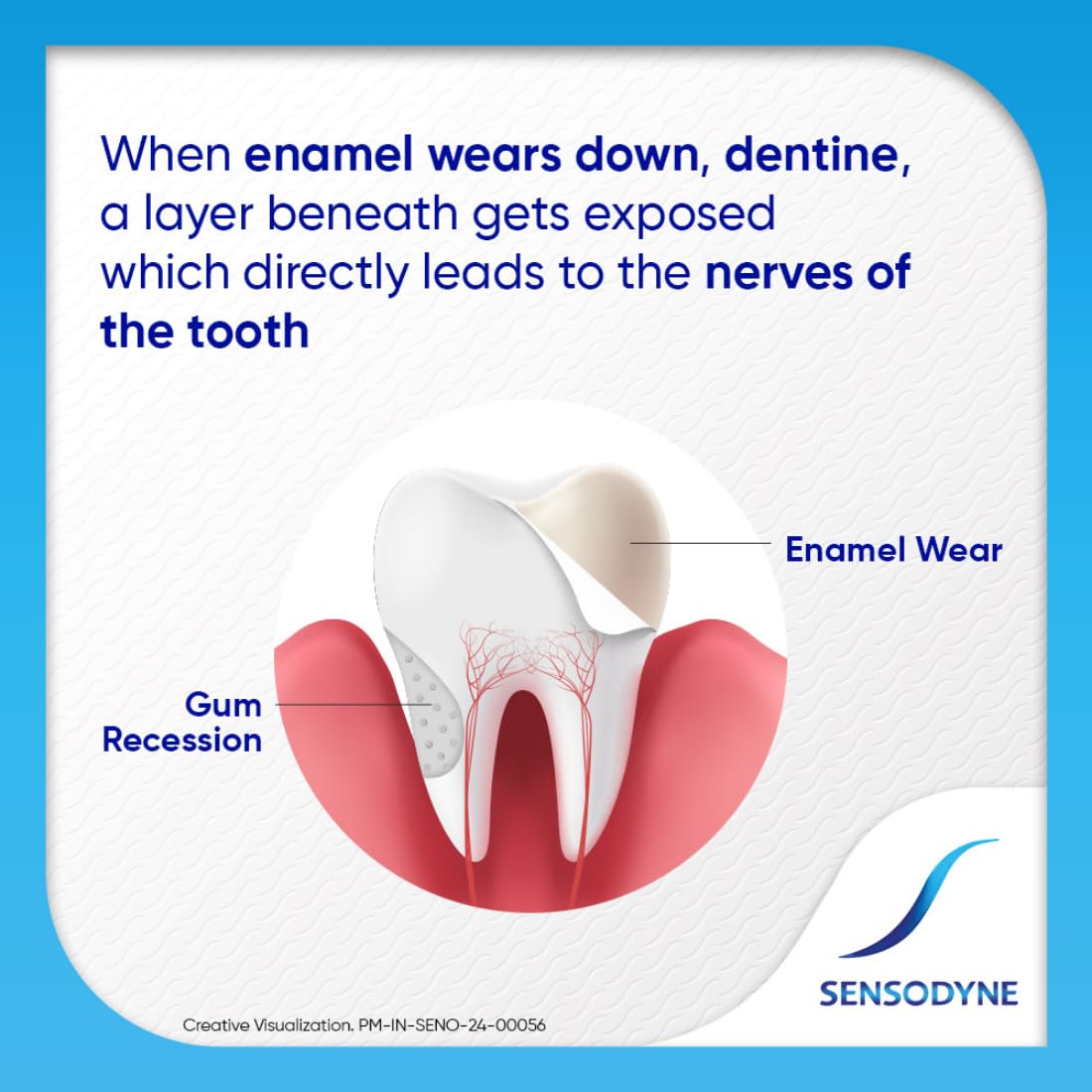 Sensodyne Toothpaste Repair and Protect | Tooth Paste for Daily Sensitivity Protection, Long-lasting Relief | Combo Pack - 140gm (70gm x 2) | Fresh Taste | Dentist Recommended