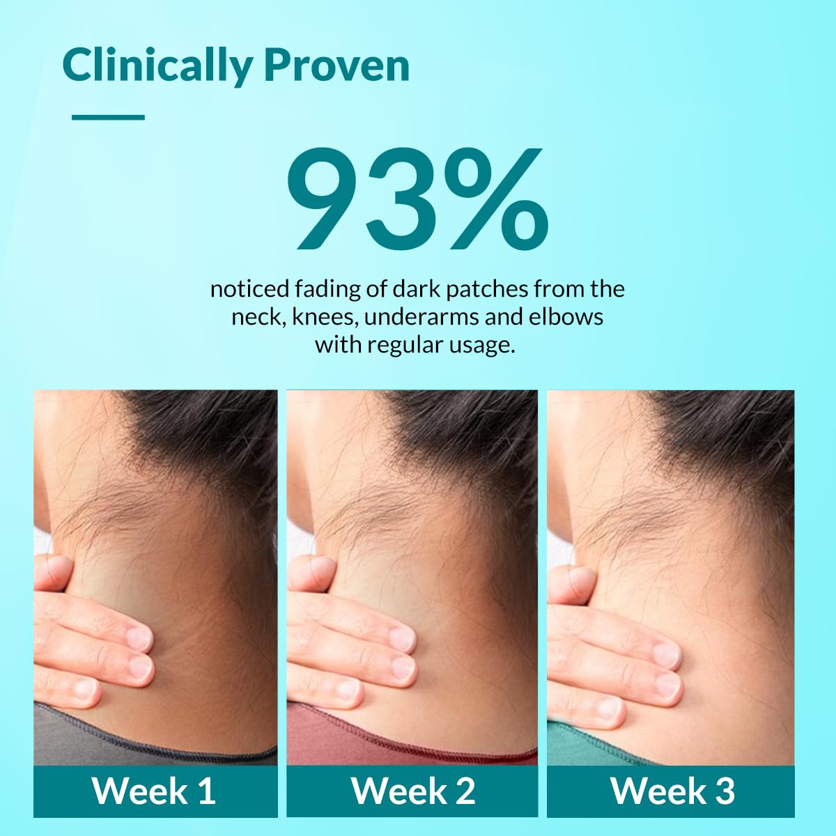 Fixderma Nigrifix Cream for Acanthosis Nigricans with Lactic Acid | Dermatologist Tested Retinol Cream | For Dark Body Parts like Neck, Ankles, Knuckles, Armpit