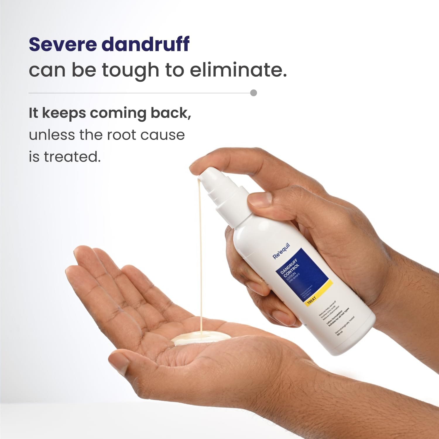 Re'equil - Dandruff Control Lotion (Pre Wash) (100ML)