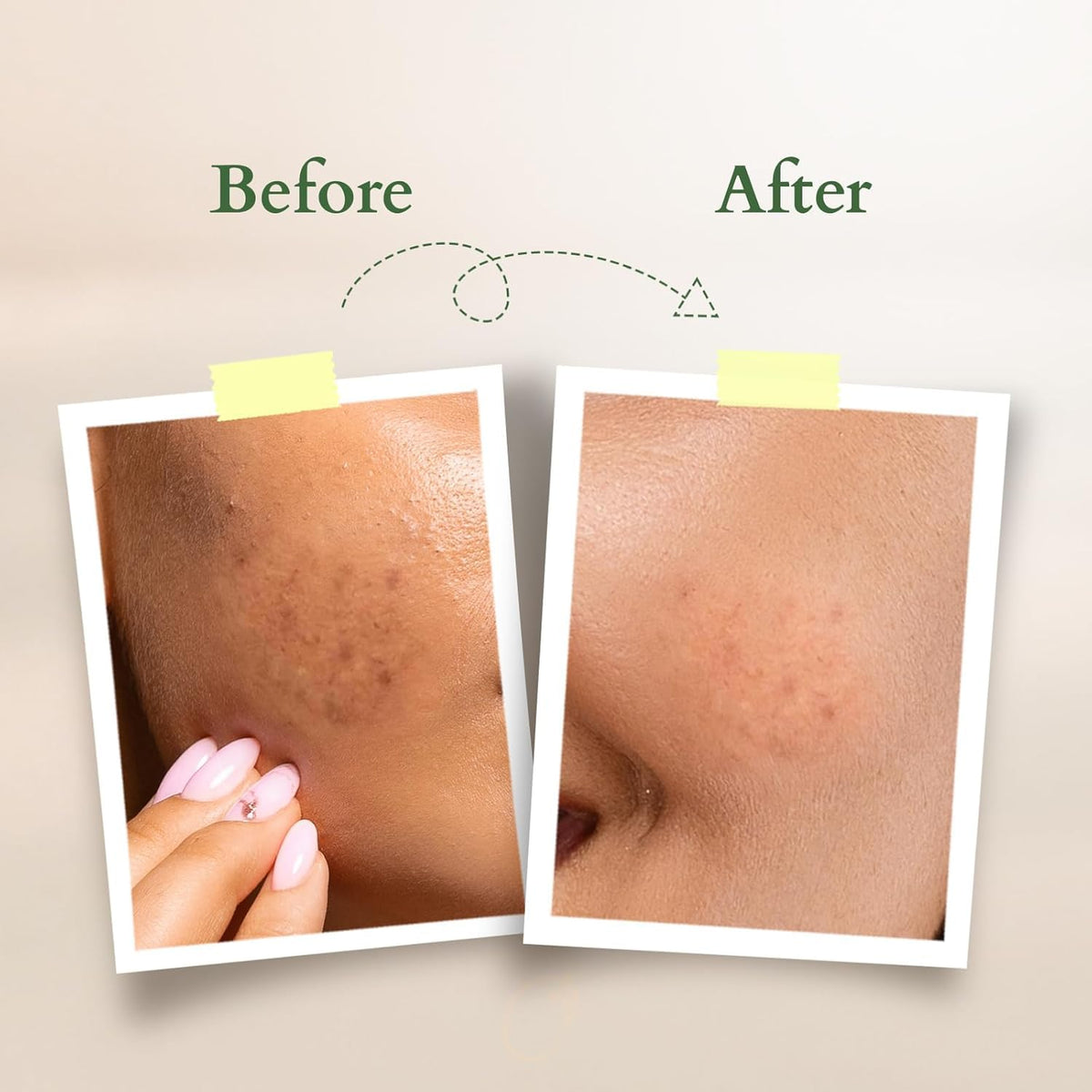 Lotus Organics+ Vitamin C Radiance Booster Face Cream | 100% Certified Organic Lemon Verbena | Boosts Collagen & Deeply Moisturises | SPF 20 PA+++ | All Skin Ty