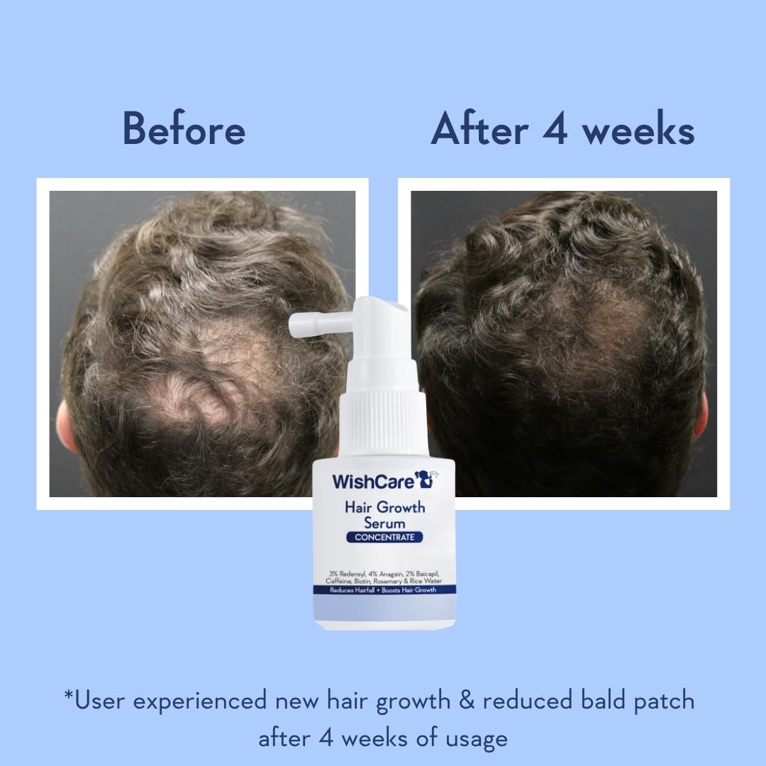 WishCare Hair Growth Serum Concentrate - Resdensyl, Anagain, Caffeine, Biotin, Keratin & Rice Water 20ml