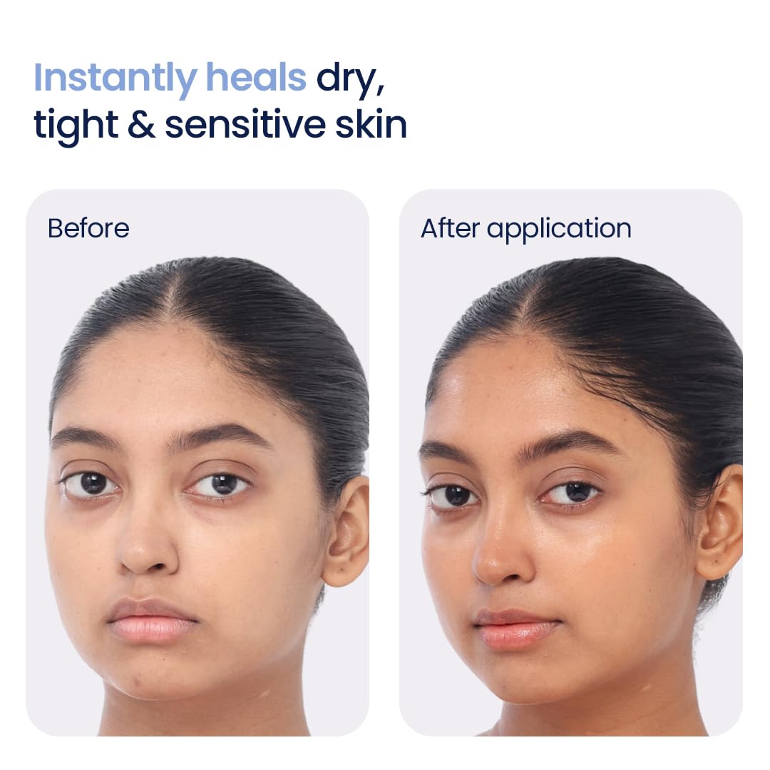 WishCare 3:1:1 Barrier Bounce Moisturiser for all Skin Types|Non-Comedogenic|Barrier Repair - 50 ml